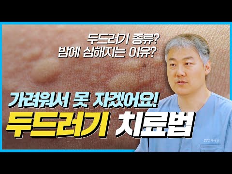 두드러기 종류부터 대처법, 치료법 총정리!