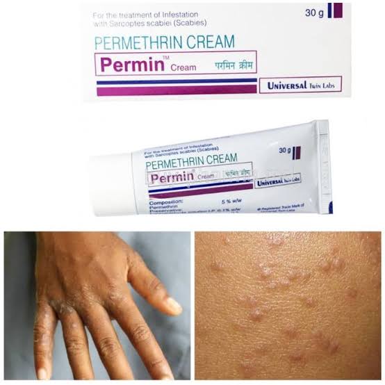 Permethrin Cream – Famedix Pharmacy