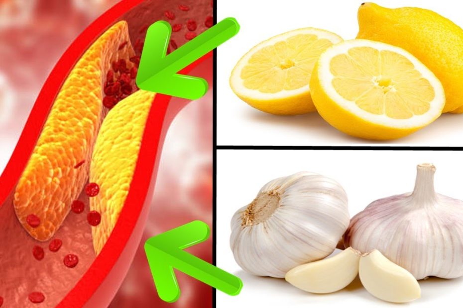 How Unclog Arteries With Lemon And Garlic Juice - Youtube